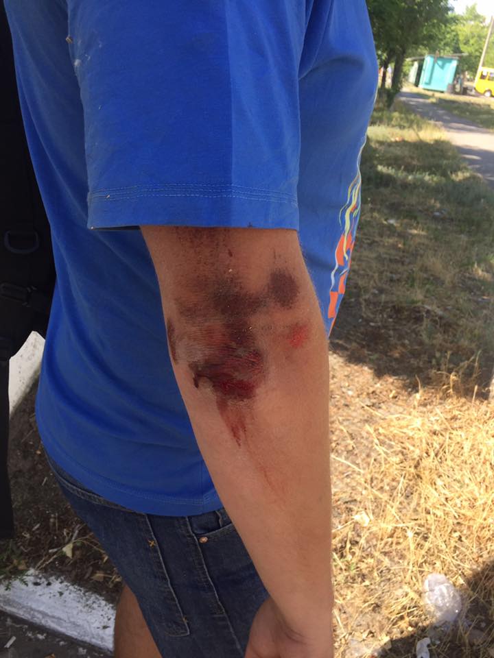 В Херсоне избили журналиста: фото