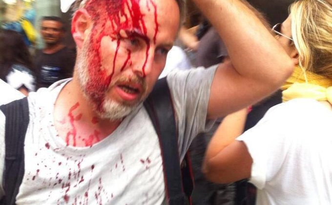 Протесты в Турции: оппозиционеры выкладывают фото жертв полиции