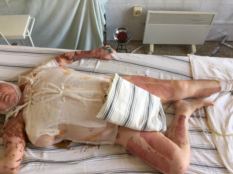 null "Катю не просто убили, а пытали": Гандзюк после атаки — фото 18+