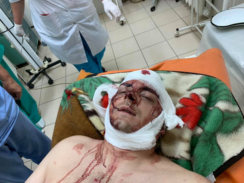 В Сумской области жестоко избили кандидата в нардепы: фото 18+