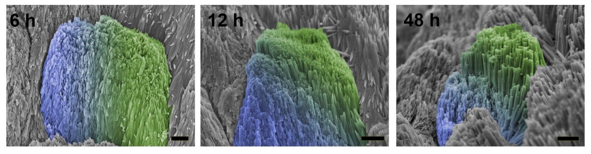 Зубная эмаль (Фото - Zhejiang University, Science Advances)