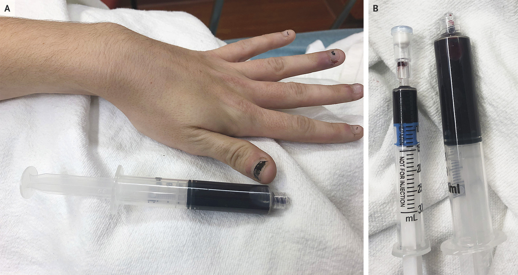 Фото - New England Journal of Medicine