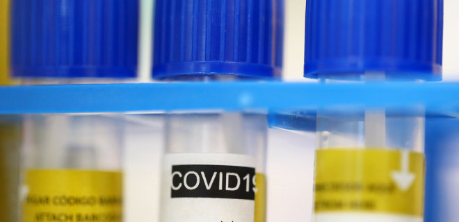История, как ученым поручили создать тесты на коронавирус, но забыли выделить деньги - Фото