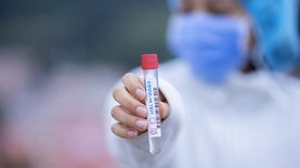 Коронавирус. Медики США пояснили, почему тест на антитела может быть бесполезен