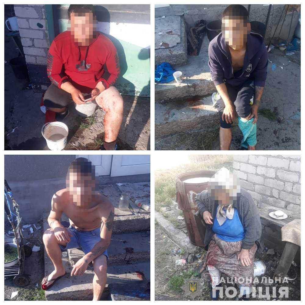 Фото: Нацполиция Под Одессой нашли на свалке гранаты и начали их разбирать. Итог – пять раненых