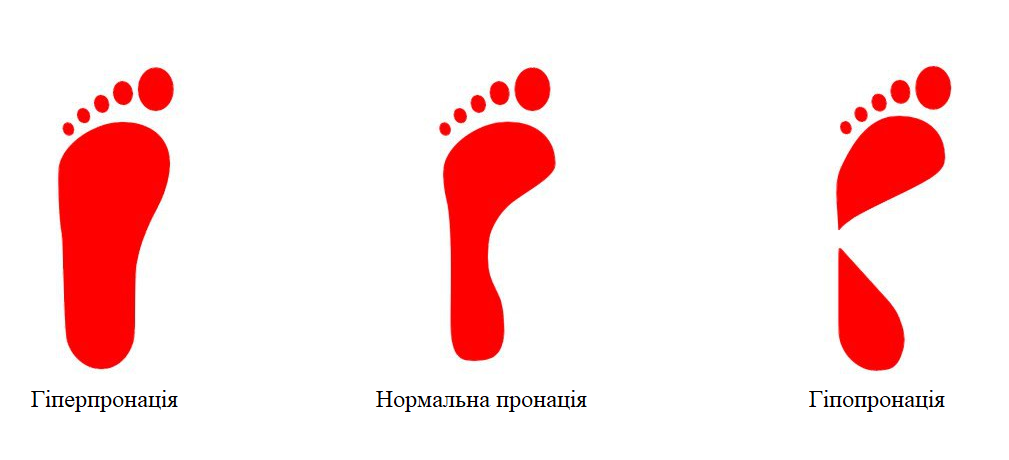 Типи пронації