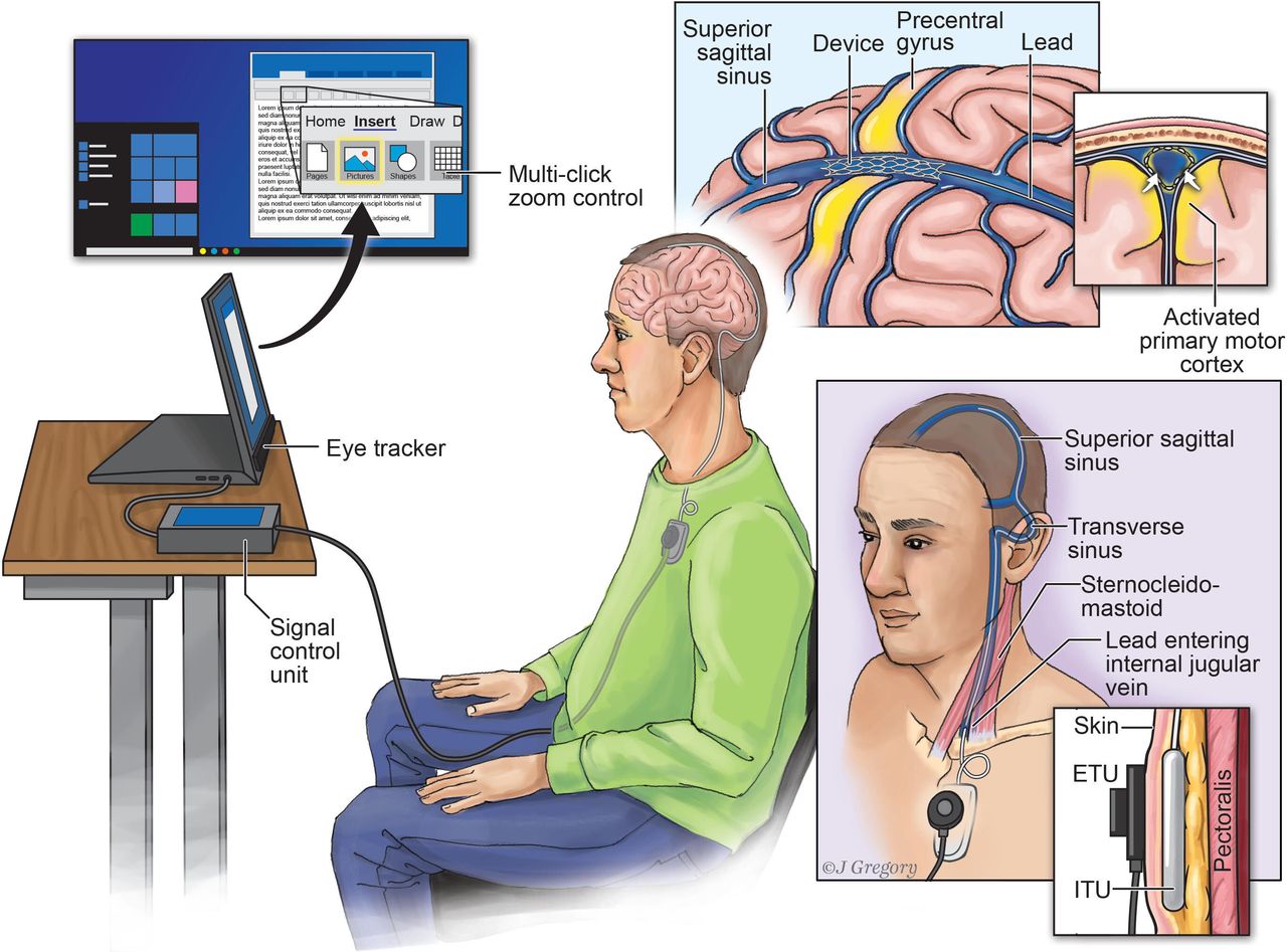 Иллюстрация: BMJ Journals Иллюстрация: BMJ Journals