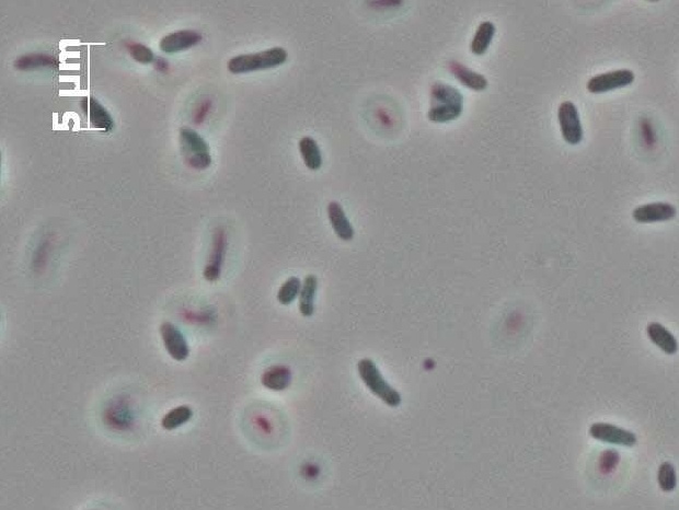 Иллюстративное фото бактерии Moritella (Leibniz-Institut DSMZ) Иллюстративное фото бактерии Moritella (Leibniz-Institut DSMZ)