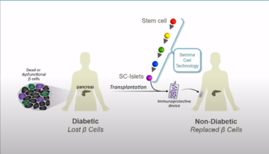 Фото: Alliance for Regenerative Medicine Фото: Alliance for Regenerative Medicine