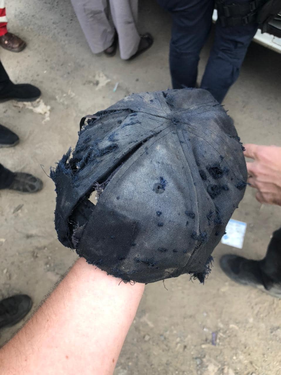 В Кривом Роге человек взорвал гранату: он лишился ноги, трое полицейских ранены