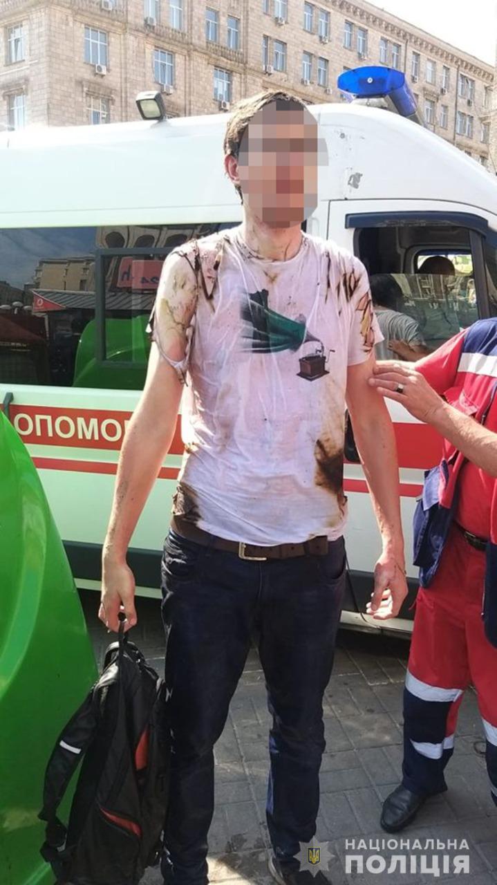 Фото: kyiv.npu.gov.ua В центре Киева мужчина совершил самоподжог: фото, видео