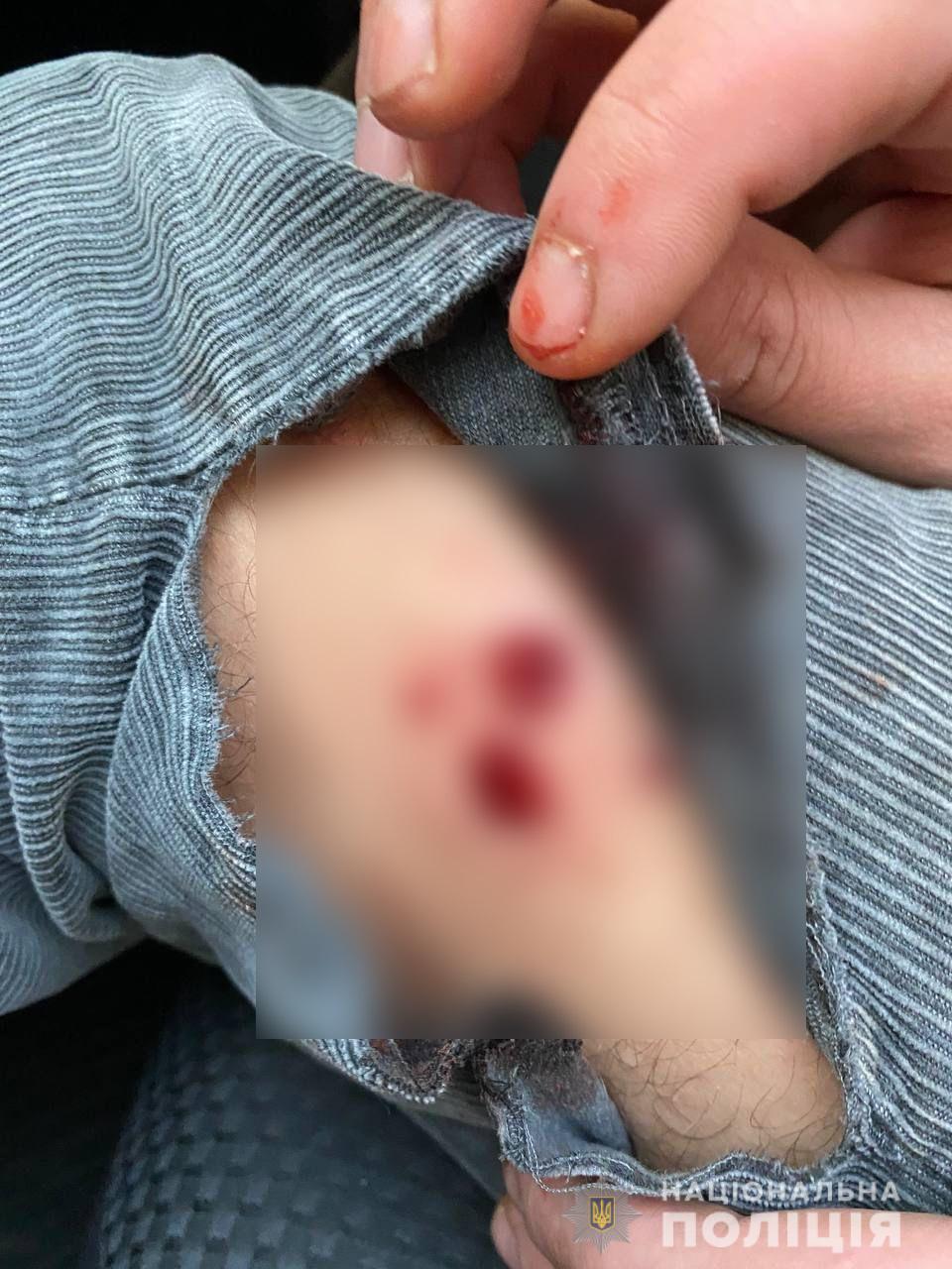 Фото: kv.npu.gov.ua Під Києвом невідомий розстріляв автомобіль із сім'єю: відео