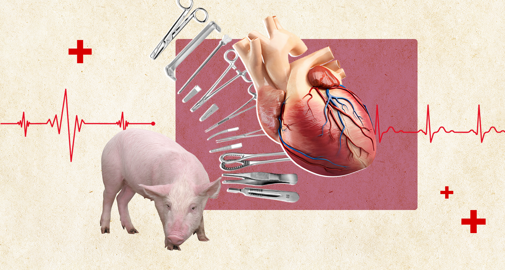 Свиное сердце. Смогут ли органы животных спасти человеческие жизни - Фото