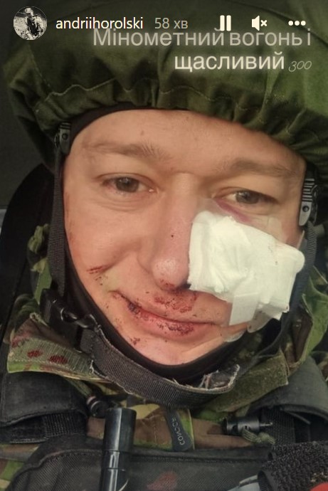 Лидер группы "Бумбокс" получил ранение после минометного обстрела: фото