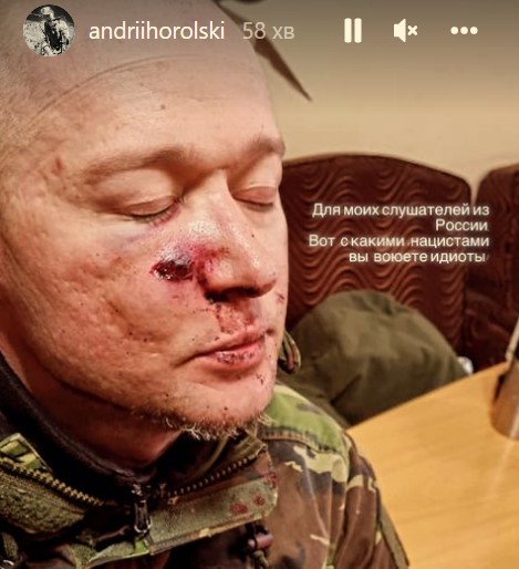 Лидер группы "Бумбокс" получил ранение после минометного обстрела: фото