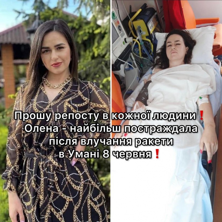 Фото: life.pravda.com.ua Ракетний удар Росії по Умані 8 червня. 26-річній постраждалій ампутували ногу